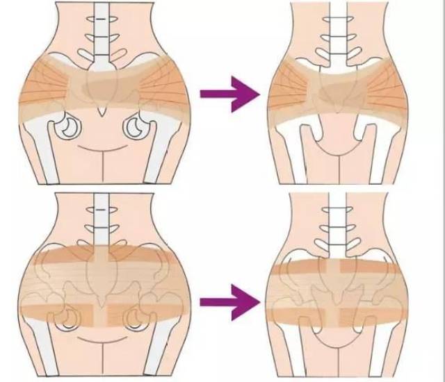产前产后骨盆变化图片图片