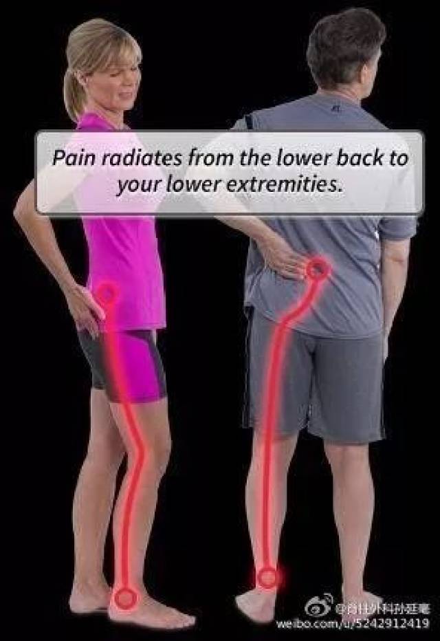 行走一段距离后疼痛剧烈,需休息片刻后才能继续行走; (2)双腿屈曲困难