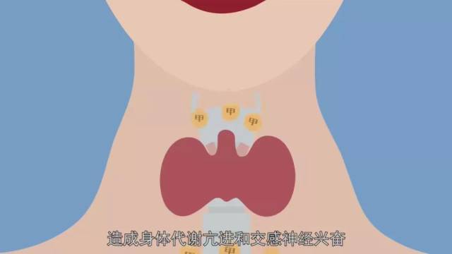从温柔萝莉到暴躁御姐只需一种病,甲亢就在你身边!