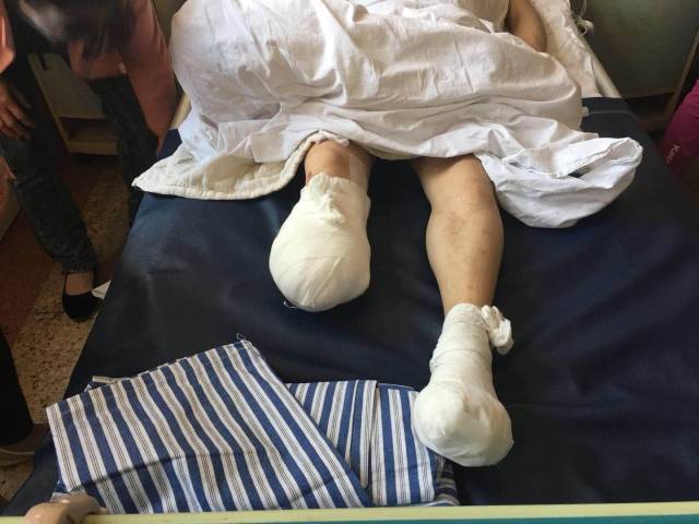 33年前被汽车撞残腿,今遭火车压断脚,男子:下次该轮飞机了?