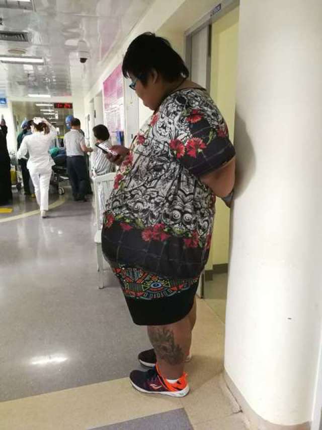 540斤!"中国第一胖"在我院成功接受减重手术