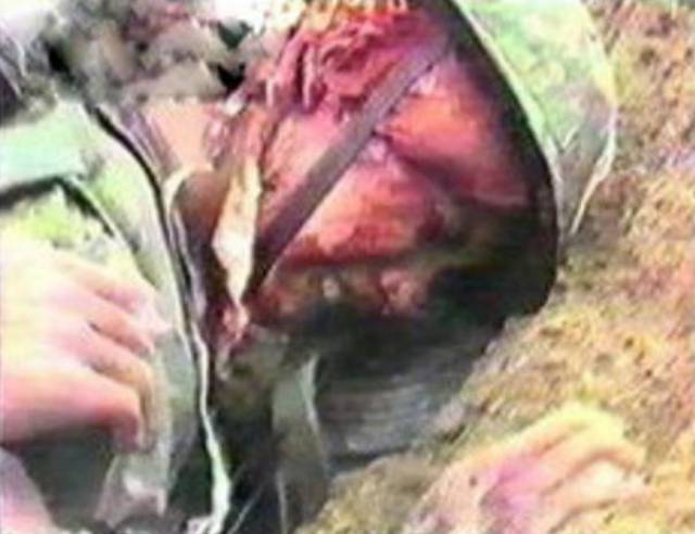 这时,越军的火炮开始对阵地进行覆盖,顾金海又一次被炮弹击中,重伤