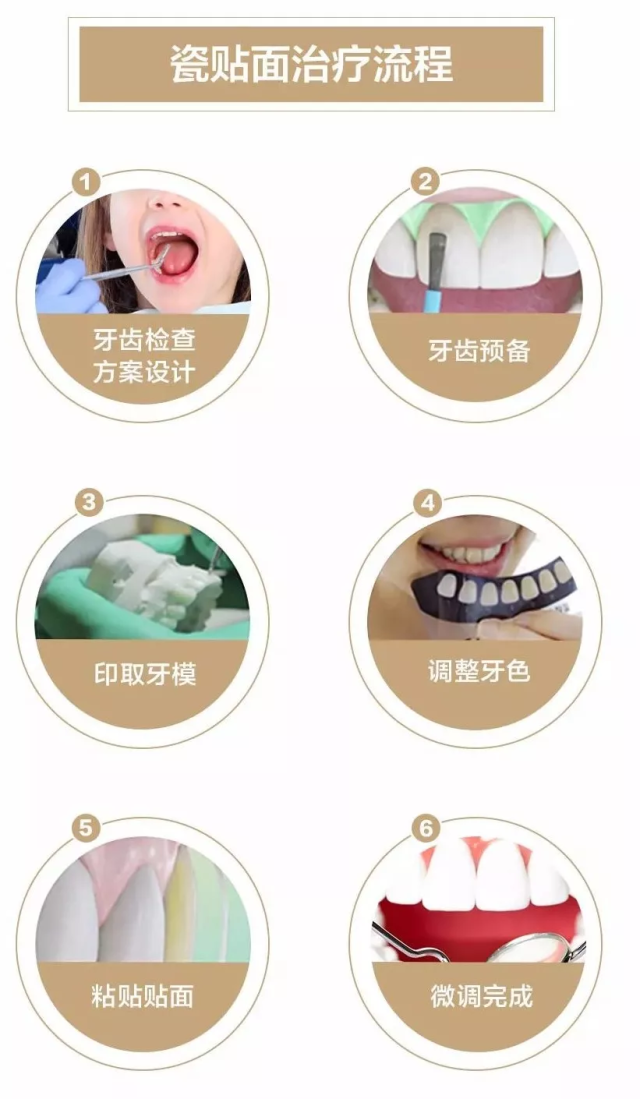 南宁"牙贴面"究竟是什么美牙神器?一贴就美!