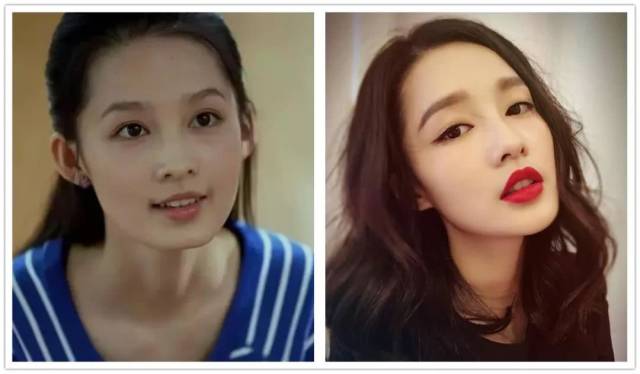 李沁的下巴这么尖,是纯天然吗?