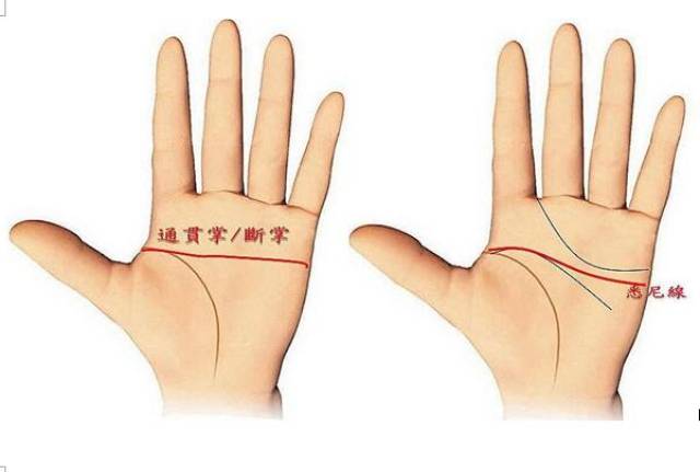 悉尼线重病来临的暗示