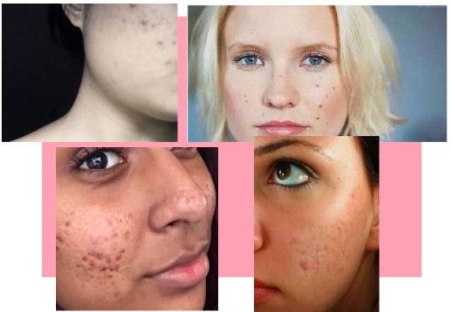 "月球表面脸"也能变成滑手的"水煮蛋"!