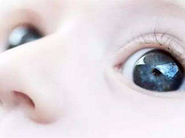 宝宝的眼睛有秘密,如果孩子出现这5种怪眼,家长一定要警惕