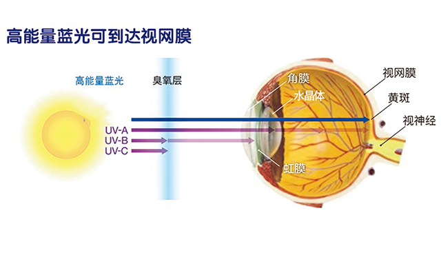 研究表明,蓝光可导致5大损伤 加重视网膜黄斑区疾病,黄斑部受损是