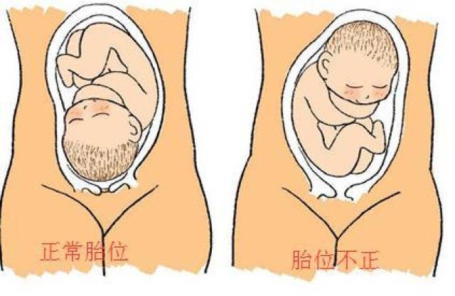 八个月听胎心的位置图图片