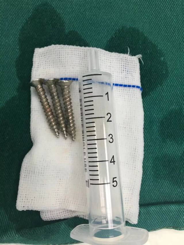 3岁男童竟给1月大弟弟喂下3枚钉子!妈妈发现时已口吐白沫面色发紫