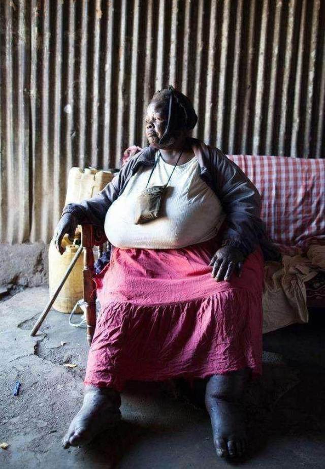 非洲一部落,女人越肥男人越喜欢,第一美人300斤胖到无法行走