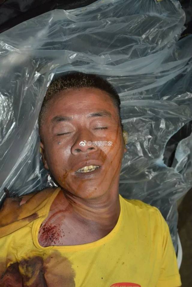 马鞍山发现一具无名尸!紧急寻找认识他的人