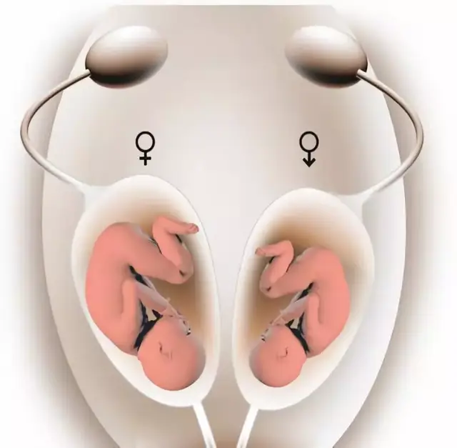 一次拥有两个宝宝,双胎秘密,想要生个双胞胎吗?