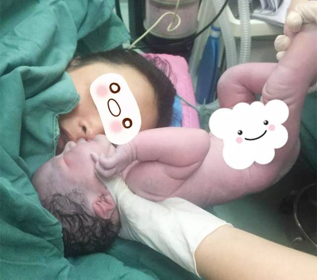 孕妈三次剖宫产喜获麟儿!