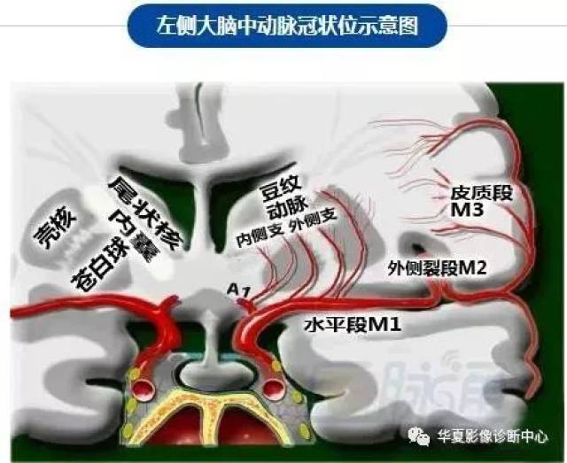 脑部断层 内囊 willis环 前联合 垂体 海马:清晰解剖图谱