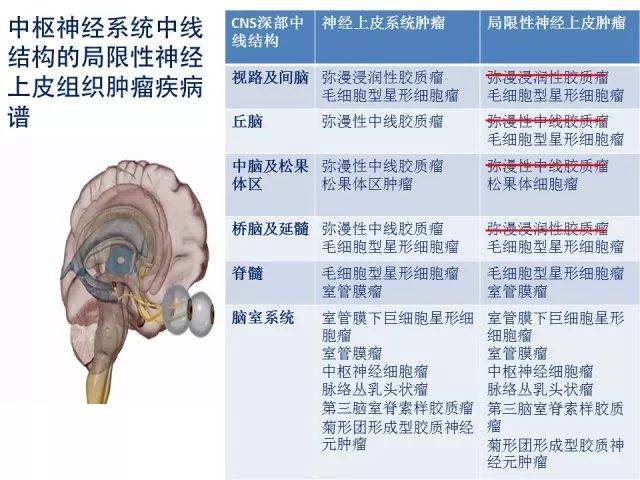 6月15日 杨学军教授 发生于中枢神经系统中线部位的局限性神经上皮