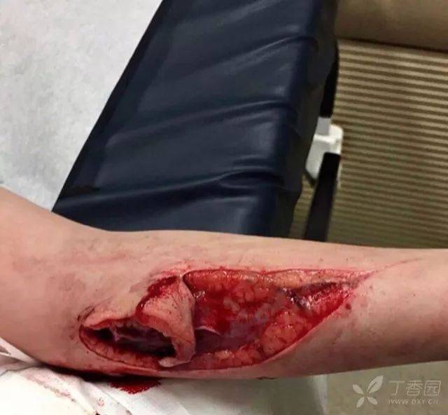 这样的缝合技术,你给打几分?