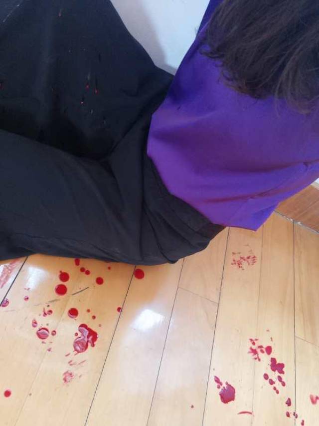 导致自己的头颅被钝器击开3厘米开外的口子,一下子鲜血直流