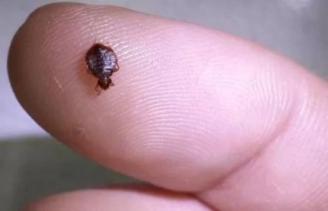 【 慎点 】一晚上被叮咬20几个包是怎样的体验!