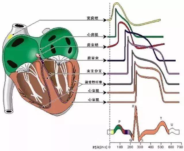 一張圖記住不穩定心絞痛和心肌梗死的發病機理與鑑別 來源:急診醫學