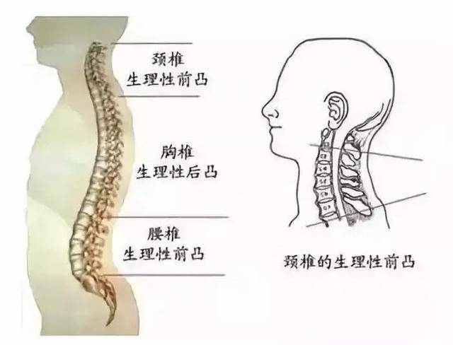 颈椎生理弯曲变直这个到底是什么意思呢?