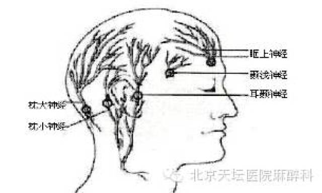 頭部傷害性知覺傳入纖維主要源於三叉神經,也有發自面神經,舌咽神經和