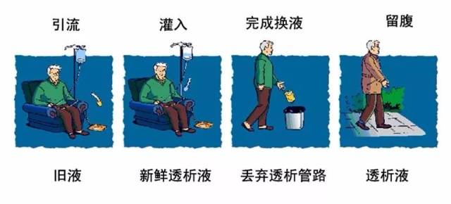 指南:腹膜透析相關感染預防