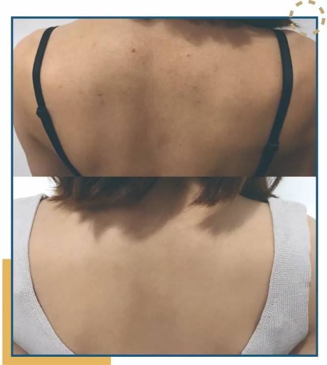 安利| 夏日光滑美背,两步就搞定.