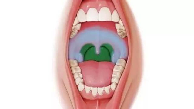 咽部充血,散在灰白色疱疹,疱疹一般出现在发烧24小时以后,位于悬雍垂