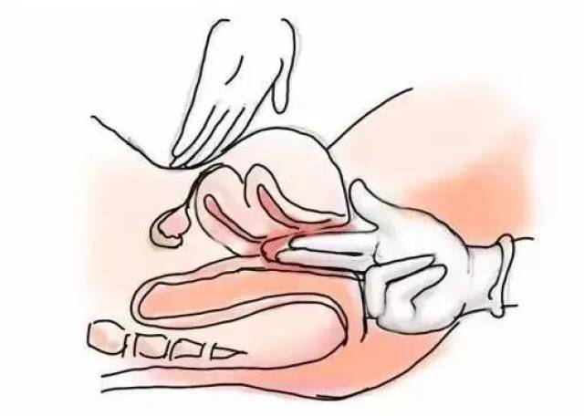 【妇科】好不容易请了假看妇科病,结果医生让我准备好了再来