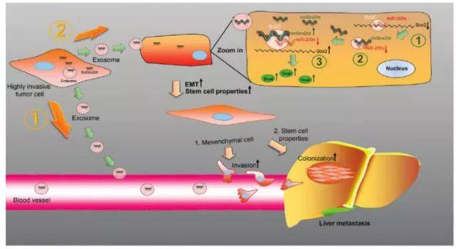 文献解读 外泌体lnc-sox2ot促进肿瘤组织上皮间充质的形成和参与