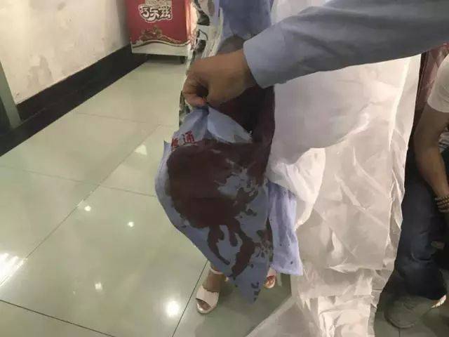 太残忍了!济南一女出租车司机被男乘客连砍三刀,倒在驾驶室!