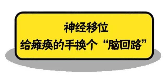 25歲小夥車禍手癱,給他換個