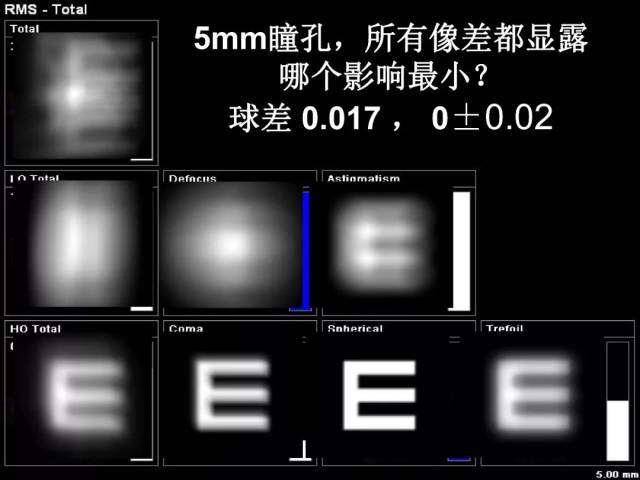 "锐视力大咖谈"丨郝燕生教授谈人眼像差与视觉质量