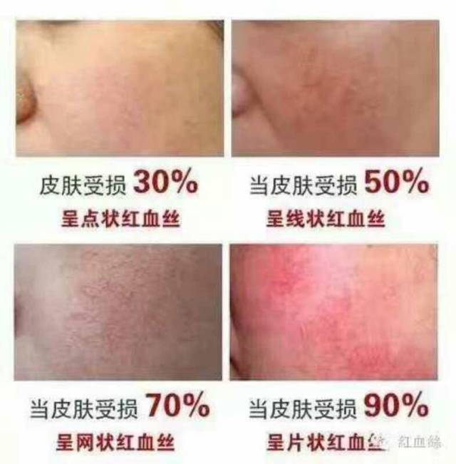 屏障修护：肌肤保护网的秘密