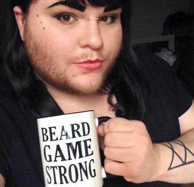 女子满脸络腮胡,被误会是男人,不刮胡子后反被追求