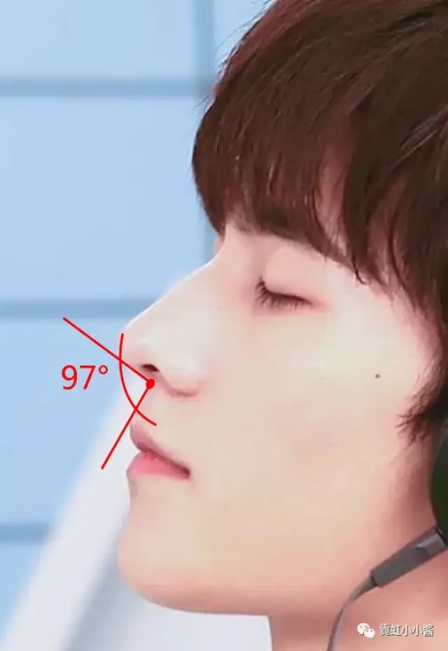 鼻面角和鼻颏角都在美学范围内. 鼻面角30~40° 鼻颏角:120~130