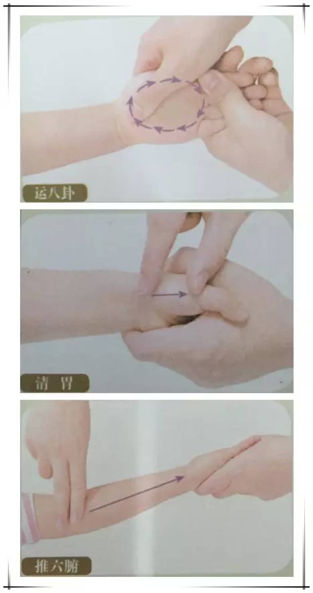 治法:选择一:推六腑15分钟,清大肠15分钟,清脾10分钟,清胃10分钟,下