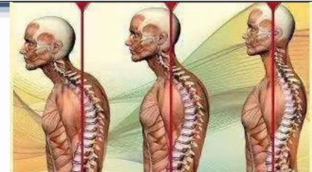 颈肩痛?胸痛?背痛?腰痛?浅谈上下交叉综合征!