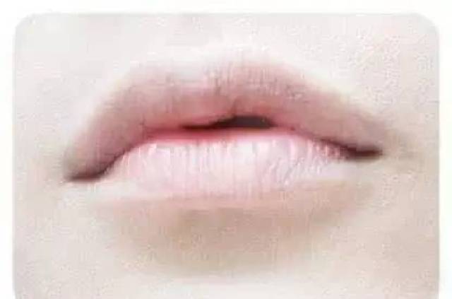 嘴唇变成紫色,白色或黑色,是什么病的征兆