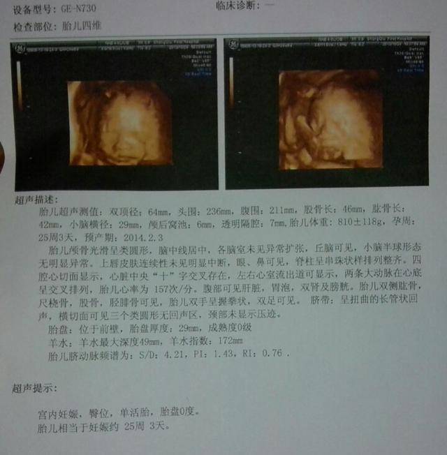 怀孕150天胎儿图片图片