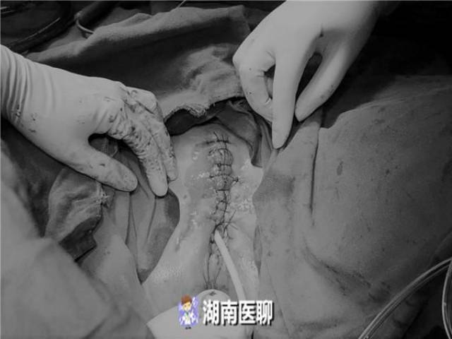 49岁女子这个部位长肿块,越长越大还发痒_手机搜狐网