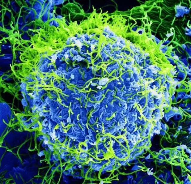 种名为拟菌病毒(mimiviridae)家族名为tupanvirus的巨大病毒进行研究