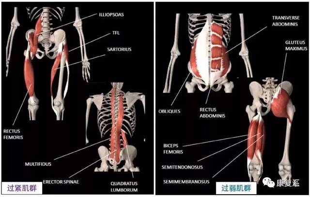 【体态纠正】骨盆前倾自我修复手册!
