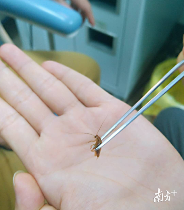 小伙睡觉蟑螂爬进耳朵,医生灌麻药取出!活物进耳千万别自行掏