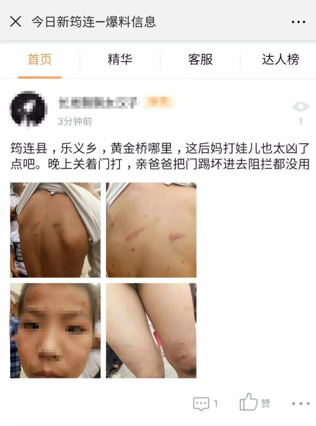 在宜宾筠连县乐义乡黄金桥一孩子被后妈打得全身伤痕累累,看了后无不