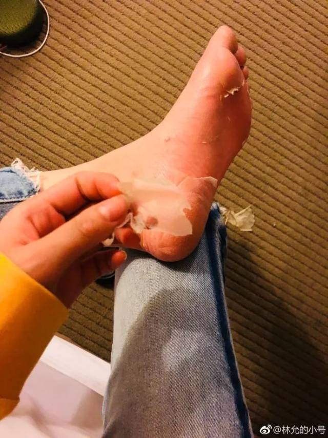 林允直播撕脚皮,网友称其想拿它炒菜吃?