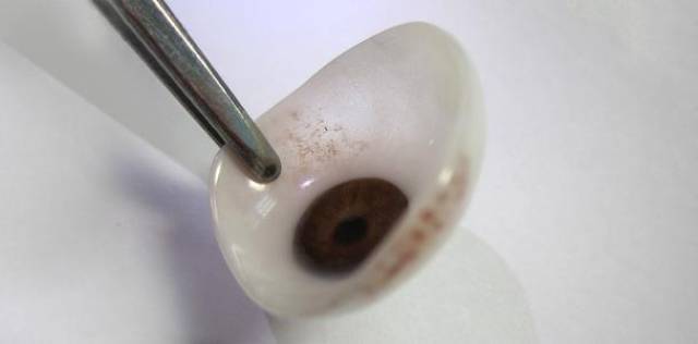 义眼片厚一些和薄一些有没有区别戴上后的结果一样吗