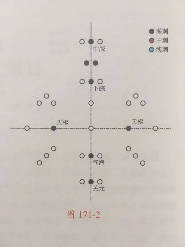 腹针神龟图详解图片