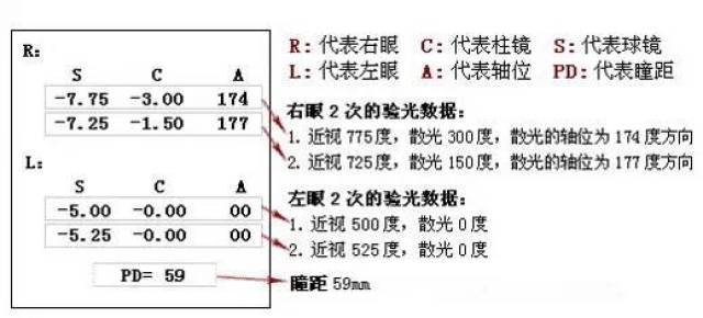 屈光轴位A图片